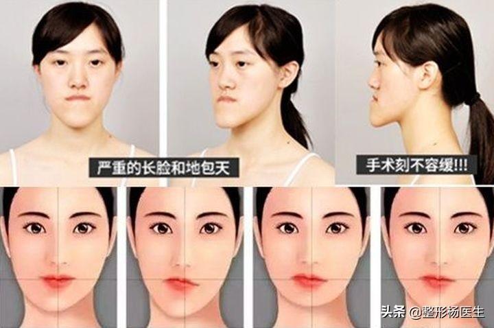 国字脸的女明星,国字脸的女明星，自信的力量与变化之美