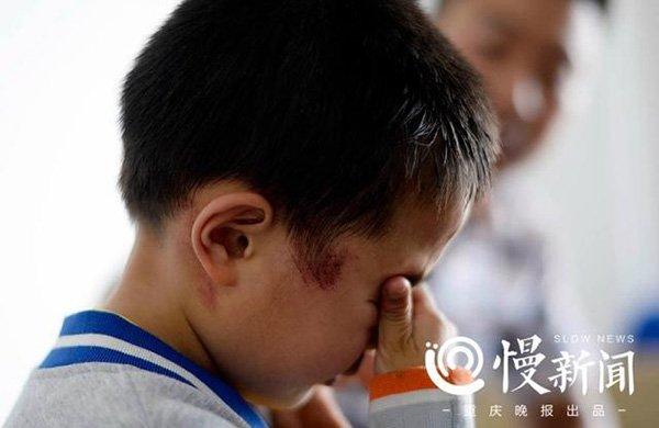 乐乐被打男婴事件最新进展